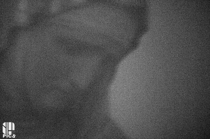 STENOPE - YVAN HANNAY